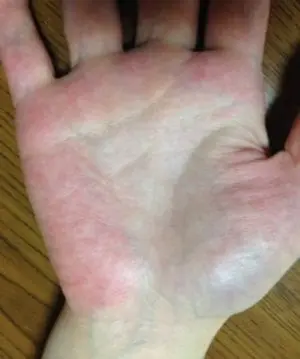 手相の生命線と寿命の関係 切れていると死ぬ は ウソ 証明写真付き 手相占い 手相占い平塚 手相 後藤