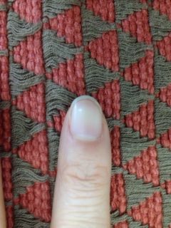 手相の爪の白点の意味は幸運！右手左手の全部の指！あなたは素晴らしい！