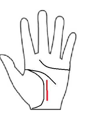 生命線のすぐ外側を並行して昇る運命線。月丘から昇り、冥王星丘ではない。