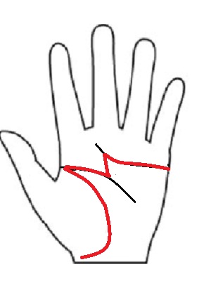 手相のラッキーMの図解イラスト。知能線から運命線が立ち上がり、感情線と生命線と合わさってM字の形を作っている「知能線優位」のラッキーMの見分け方を示した画像。