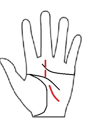 典型的な運命線の途切れ途切れ