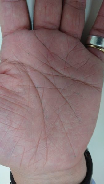 手相の線が濃い