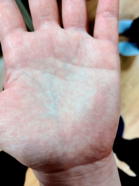 手相の線が薄い