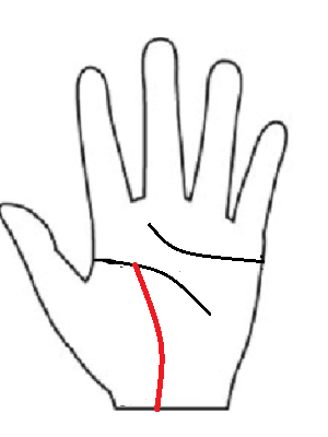 100歳の方の手相イラスト。生命線が流年法の70歳付近で止まっている実録エピソードの図解。