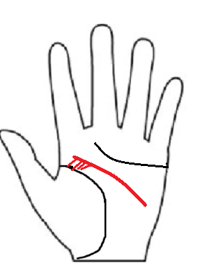 生命線から離れた知能線の起点に、生命線への橋渡し線が複数出ている「空気読みすぎ離れ知能線」の図解。本来の大胆さと周囲への配慮が共存する相。