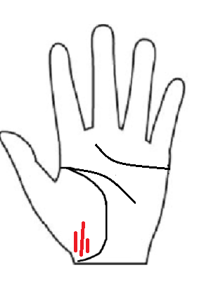 手相の陰徳線（いんとくせん）の図解。親指の付け根（金星丘）にある短い縦線で、無意識に人を支える「徳」の才能やサポーターとしての資質を示す。