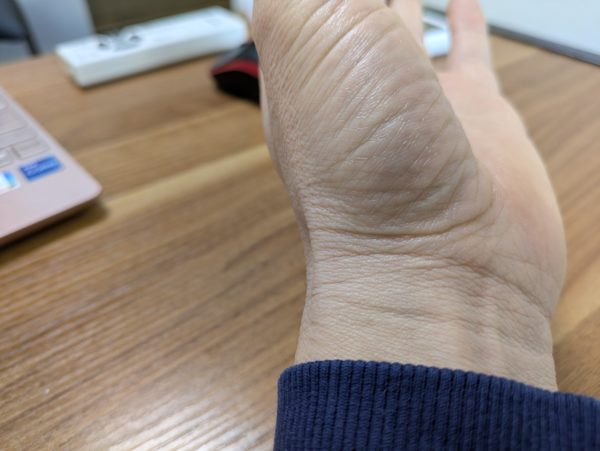 生命線の長さと寿命の誤解を解くための手相実例